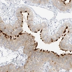 Immunohistochemical staining of human fallopian tube shows strong positivity in cilia in glandular cells.