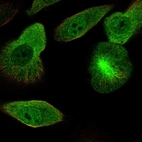 Immunofluorescent staining of human cell line RPTEC TERT1 shows localization to nucleoplasm, cytosol, microtubule organizing center & mitotic spindle.