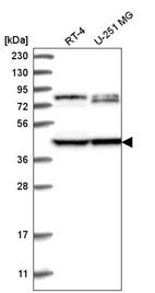 Anti-DCDC2 Antibody