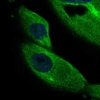 Immunofluorescent staining of human cell line RPTEC TERT1 shows localization to cytosol, microtubule organizing center, microtubules & mitotic spindle.