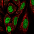Immunofluorescent staining of human cell line SiHa shows localization to nucleoplasm.