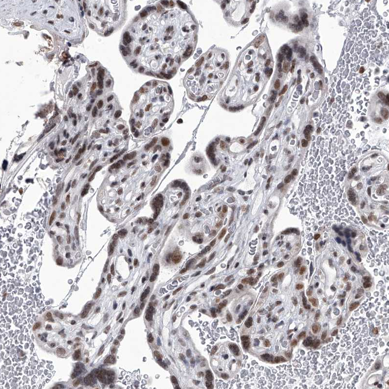 Anti-PPIL4 Antibody