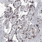Anti-PPIL4 Antibody