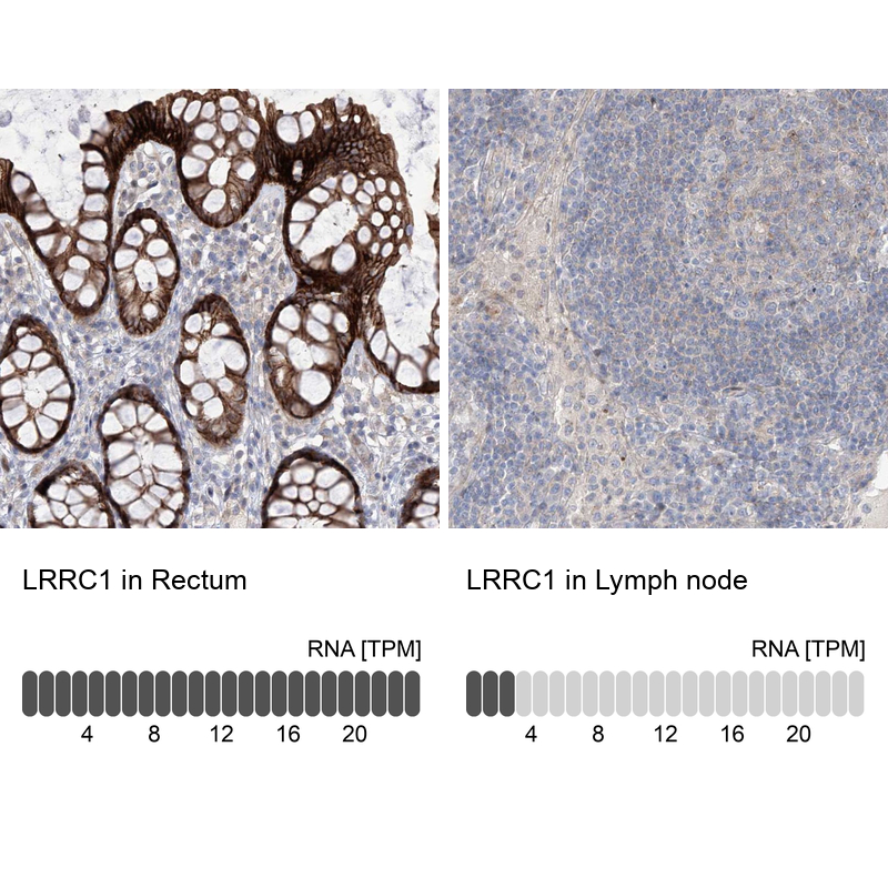 Anti-LRRC1 Antibody