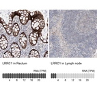 Anti-LRRC1 Antibody