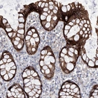 Immunohistochemical staining of human rectum shows high expression.