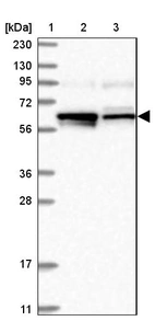 Lane 1: Marker [kDa] 230, 130, 95, 72, 56, 36, 28, 17, 11_br/_Lane 2: Human cell line RT-4_br/_Lane 3: Human cell line U-251MG sp