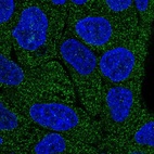 Immunofluorescent staining of human cell line RT4 shows localization to cytosol.