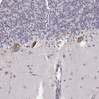 Immunohistochemical staining of human cerebellum shows strong cytoplasmic positivity in Purkinje cells.