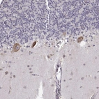 Immunohistochemical staining of human cerebellum shows strong cytoplasmic positivity in Purkinje cells.