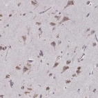 Immunohistochemical staining of human cerebral cortex shows moderate cytoplasmic positivity in neuronal cells.
