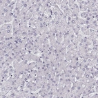 Immunohistochemical staining of human liver shows no positivity in hepatocytes as expected.