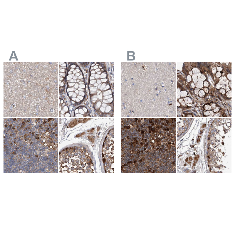 Anti-ASCC3 Antibody