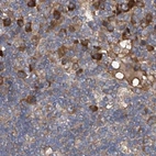 Immunohistochemical staining of human lymph node using Anti-ASCC3 antibody HPA031608.