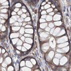 Immunohistochemical staining of human colon using Anti-ASCC3 antibody HPA031608.