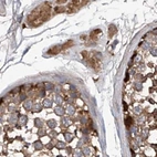 Immunohistochemical staining of human testis using Anti-ASCC3 antibody HPA031608.