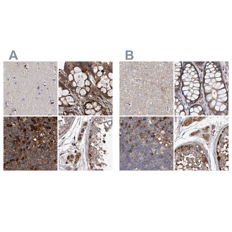 Anti-ASCC3 Antibody