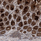 Immunohistochemical staining of human duodenum shows moderate to strong cytoplasmic positivity in glandular cells.