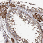 Immunohistochemical staining of human testis shows moderate to strong cytoplasmic positivity in Leydig cells.