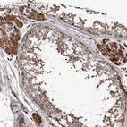 Immunohistochemical staining of human testis shows moderate to strong cytoplasmic positivity in Leydig cells.