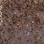 Immunohistochemical staining of human lymph node shows moderate to strong cytoplasmic positivity in lymphoid cells.