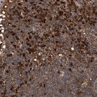 Immunohistochemical staining of human lymph node shows moderate to strong cytoplasmic positivity in lymphoid cells.