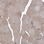 Immunohistochemical staining of human skeletal muscle shows weak to moderate cytoplasmic positivity in myocytes.