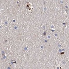 Immunohistochemical staining of human cerebral cortex using Anti-ASCC3 antibody HPA031609.