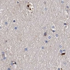 Immunohistochemical staining of human cerebral cortex using Anti-ASCC3 antibody HPA031609.