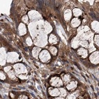Immunohistochemical staining of human colon using Anti-ASCC3 antibody HPA031609.