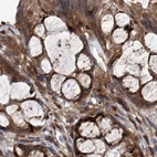 Immunohistochemical staining of human colon using Anti-ASCC3 antibody HPA031609.