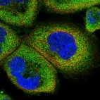 Immunofluorescent staining of human cell line A-431 shows localization to cytosol.