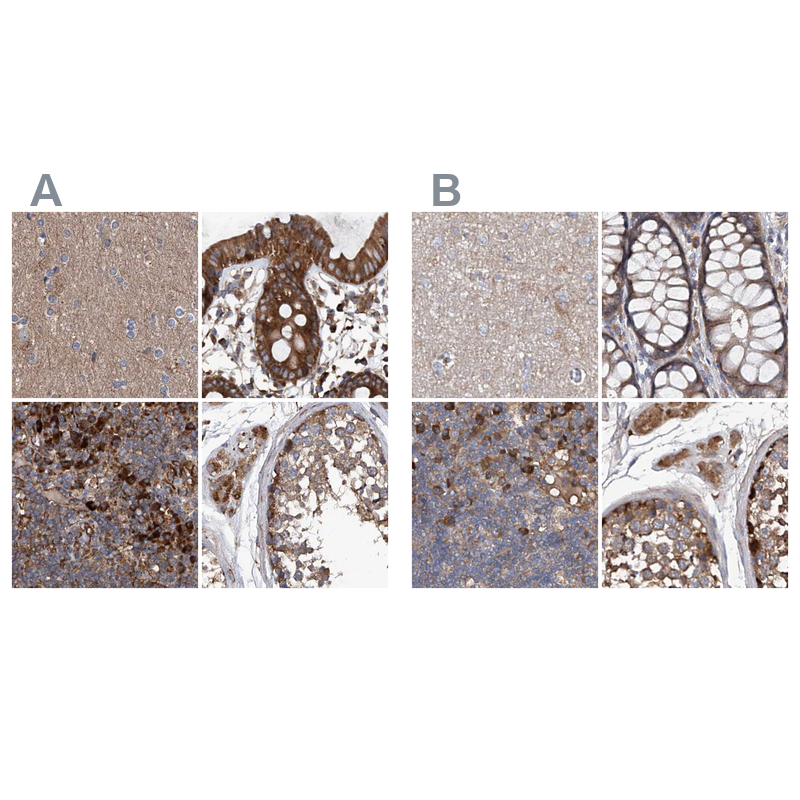 Anti-ASCC3 Antibody