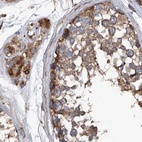 Immunohistochemical staining of human testis using Anti-ASCC3 antibody HPA031610.