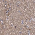 Immunohistochemical staining of human cerebral cortex using Anti-ASCC3 antibody HPA031610.
