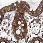 Immunohistochemical staining of human colon using Anti-ASCC3 antibody HPA031610.