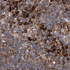 Immunohistochemical staining of human lymph node using Anti-ASCC3 antibody HPA031610.