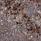 Immunohistochemical staining of human lymph node using Anti-ASCC3 antibody HPA031610.