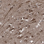 Anti-FOXRED2 Antibody