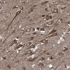 Anti-FOXRED2 Antibody