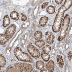 Anti-FOXRED2 Antibody