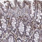 Immunohistochemical staining of human rectum shows strong cytoplasmic positivity in lymphoid cells.