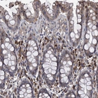 Immunohistochemical staining of human rectum shows strong cytoplasmic positivity in lymphoid cells.