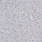 Immunohistochemical staining of human cerebral cortex shows no positivity in neurons as expected.