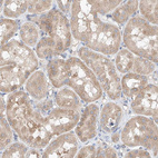 Immunohistochemical staining of human kidney shows moderate granular cytoplasmic positivity in cells in tubules.