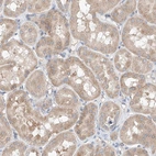 Immunohistochemical staining of human kidney shows moderate granular cytoplasmic positivity in cells in tubules.
