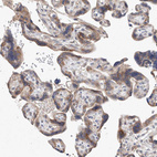 Immunohistochemical staining of human placenta shows moderate granular cytoplasmic positivity in trophoblastic cells.