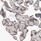 Immunohistochemical staining of human placenta shows moderate granular cytoplasmic positivity in trophoblastic cells.