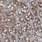 Immunohistochemical staining of human duodenum shows strong granular cytoplasmic positivity in glandular cells.
