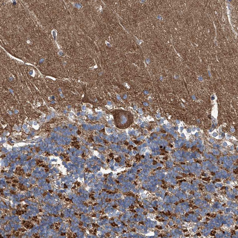 Anti-PIGH Antibody